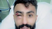 شاهد إصابة مرعبة لـ أحمد الحبيب نجم أبها بعد مواجهة النصر